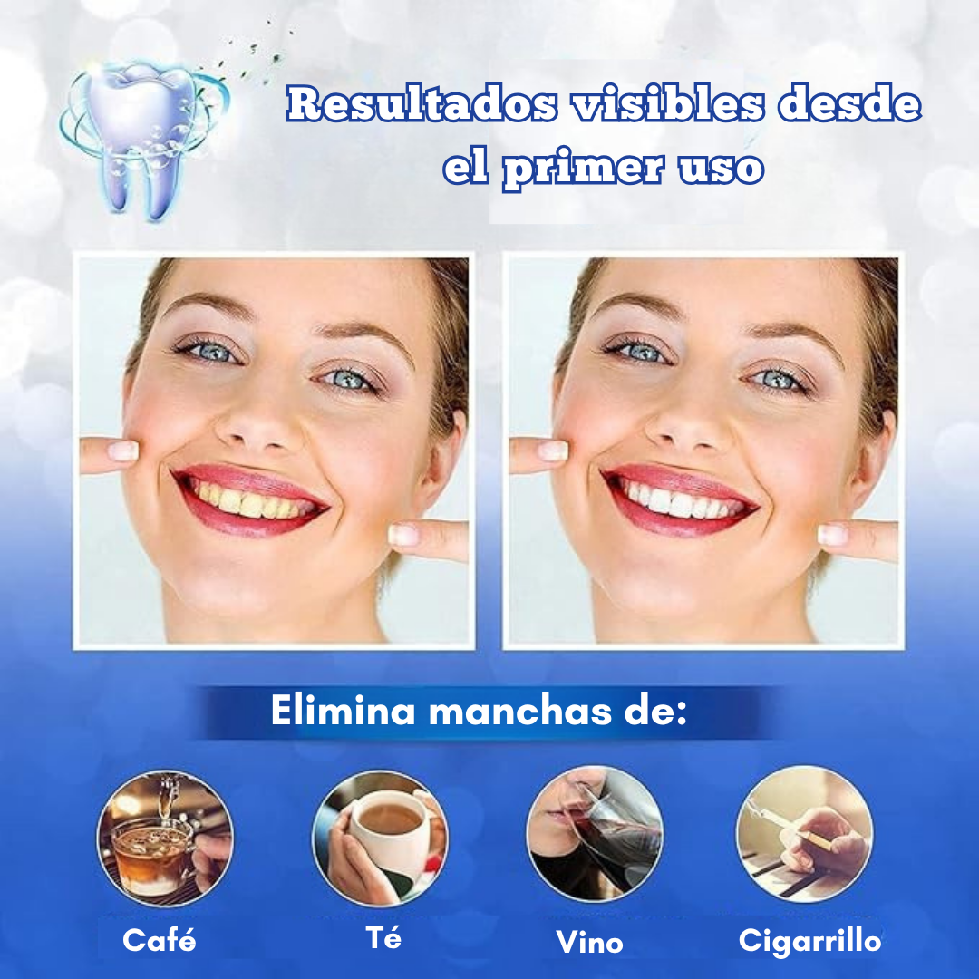 WhiteTeeth| Tiras Blanqueadoras Dentales 5D