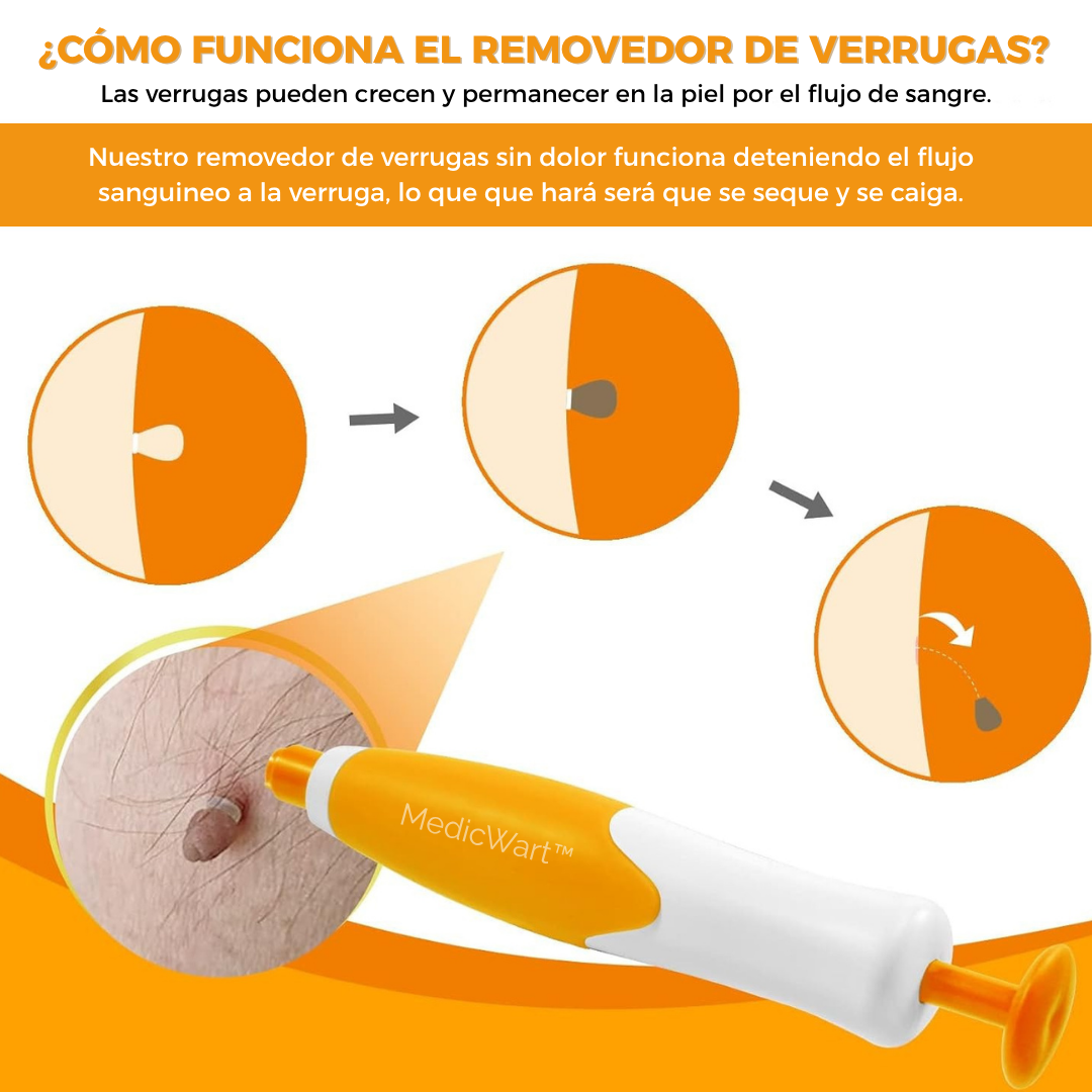 MedicWart: Kit Eliminación de Verrugas Sin Dolor