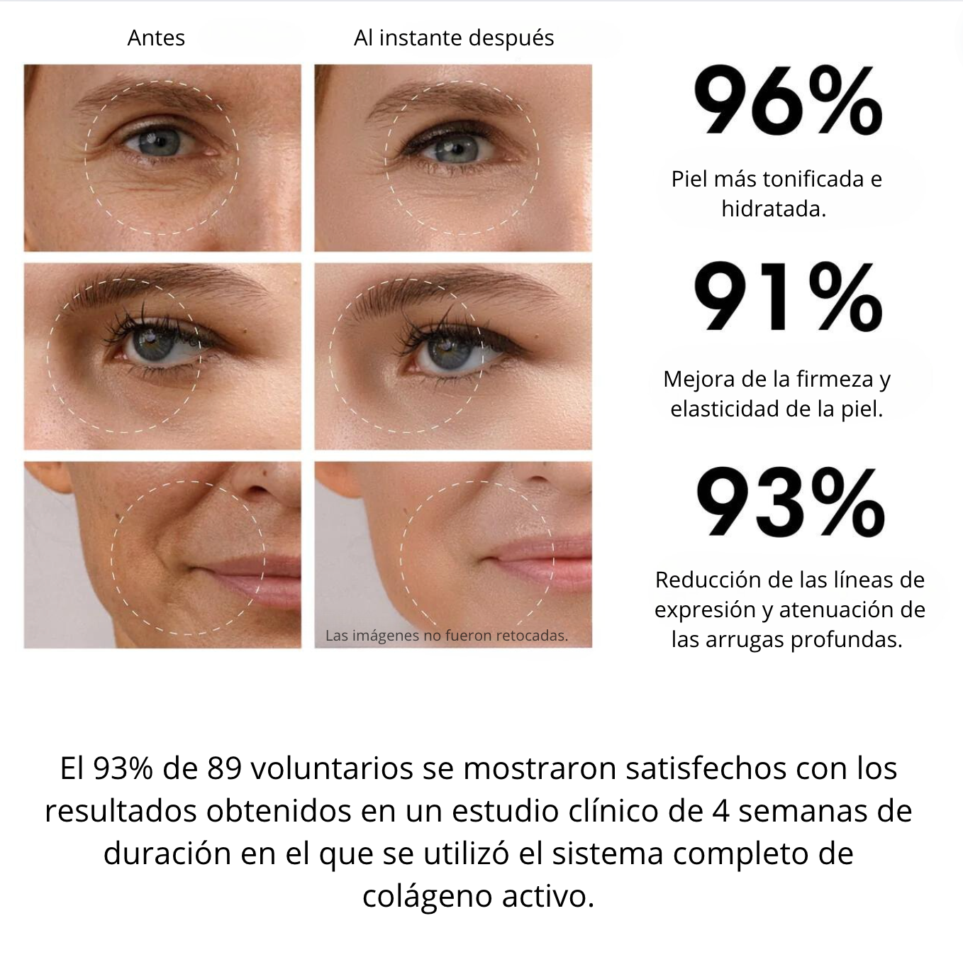 Parches de colágeno efecto lifting | HydraLift Collagen